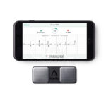 AliveCor KardiaMobile