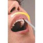 OraQuick Home HIV Self-Test (Mouth Swab)
